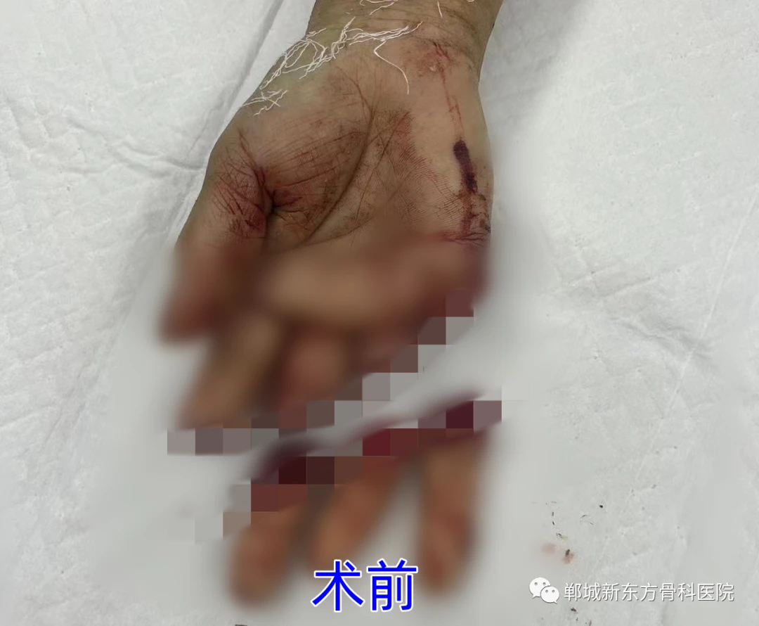 86fe1d1f1ad61197e869cd7158c1ef7b.png 86fe1d1f1ad61197e869cd7158c1ef7b.png