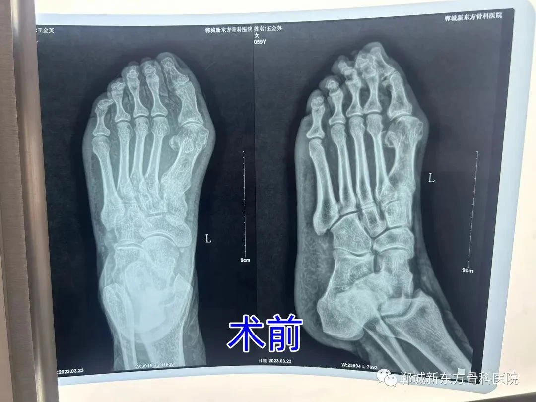 efad2b1874dee88f38e3f7dbf17ddad1.jpg efad2b1874dee88f38e3f7dbf17ddad1.jpg