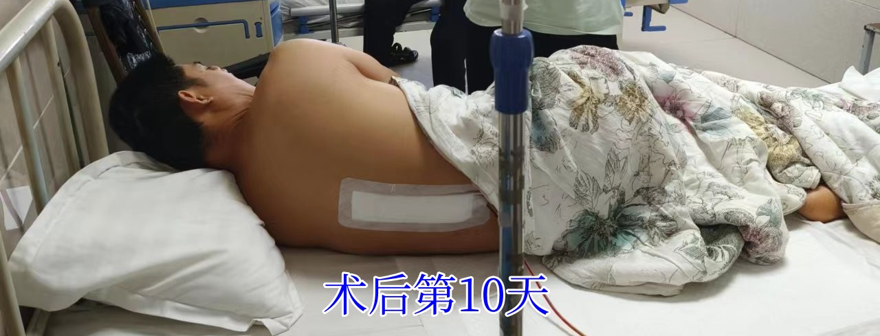 腰椎间盘突出，作为现代社会中常见的脊椎疾病之应当如何锻炼